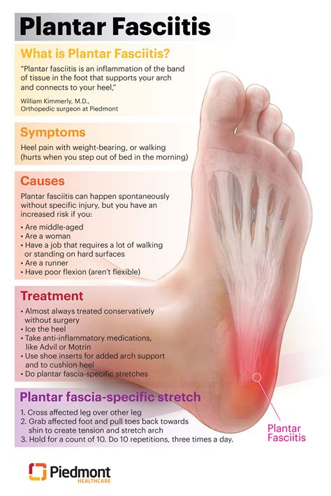 plantar fascia impact testing|diagram of plantar fasciitis.